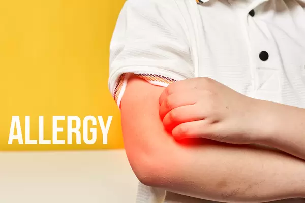 A little boy scratching his allergic skin