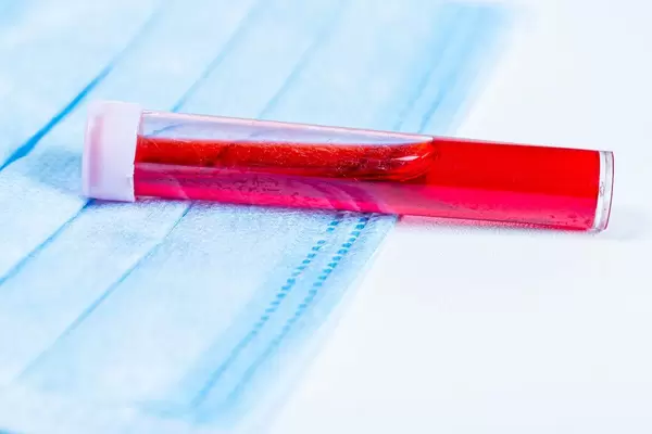 A test tube of blood and medical mask