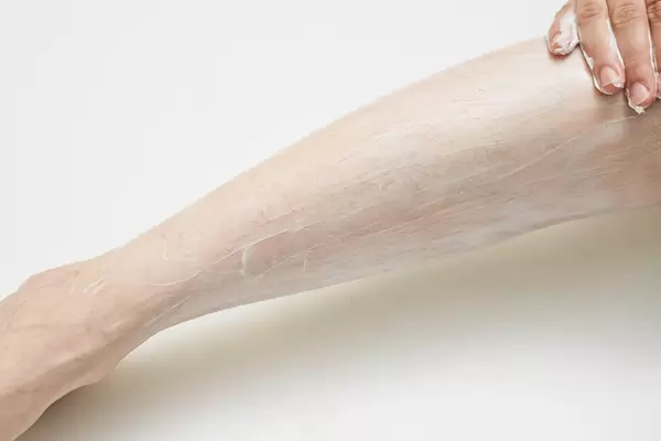 A woman applying hair removing cream on her leg