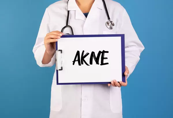 Arzt hält ein Schild mit der Schrift 'Akne' im blauen Hintergrund