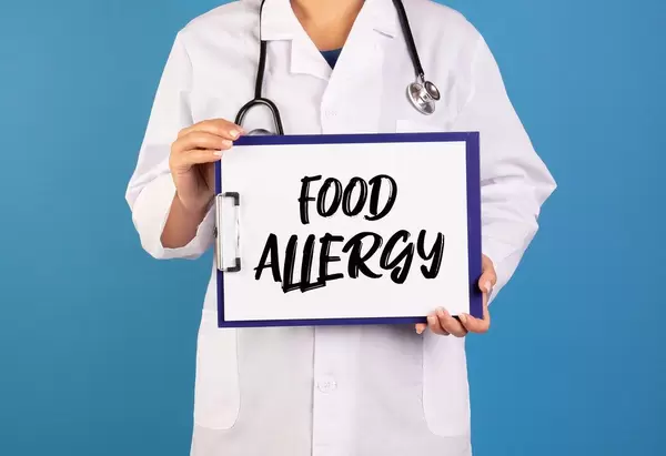 Arzt hält ein Schild mit der Schrift 'Food Allergy' im blauen Hintergrund