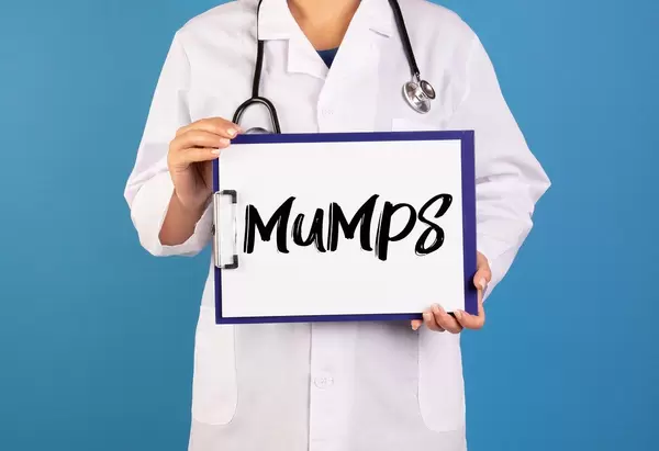 Arzt hält ein Schild mit der Schrift 'Mumps' im blauen Hintergrund