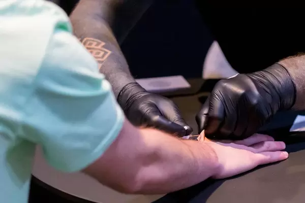 Biohax Implantation in between forefinger and thumb on Digital X in Cologne