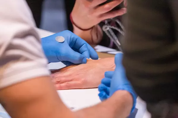 Biohax Implantation von NFC Chips in die Hand