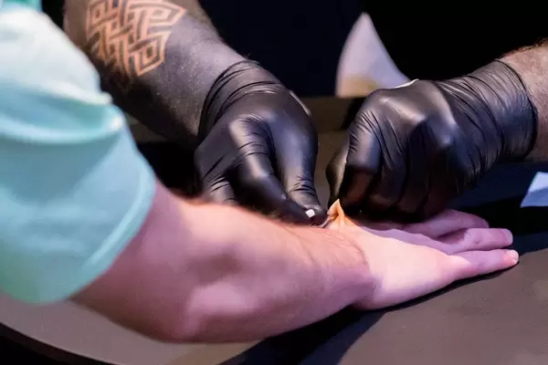 Biohax NFC Chip wird unter die Haut transplantiert auf der Digital X in Köln