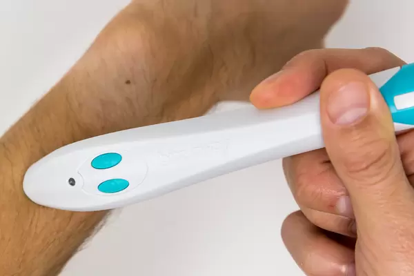 Bite Away: chemical-free device to reduce pain and swelling from insect bites (mosquitos, wasps, bees)