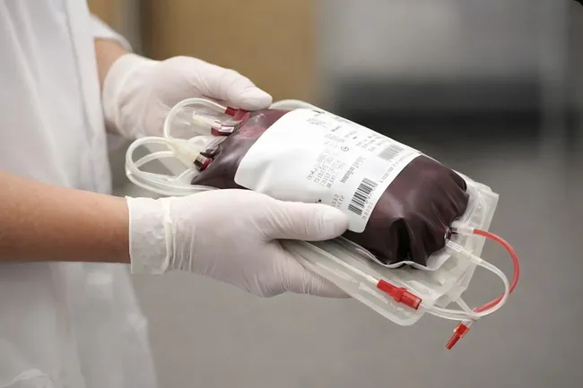 Blutkonserve in Krankenhaus-Arbeitsumgebung