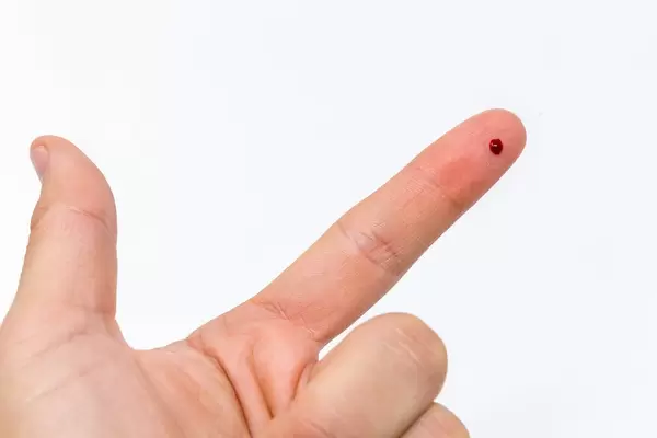 Bluttropfen auf einem Finger nach Einstich mit Nadel
