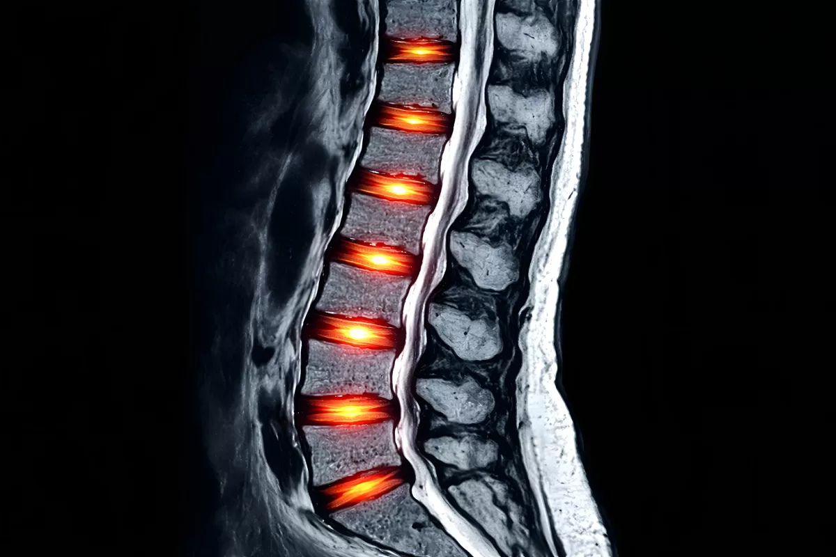 Brennende Kohlestücke in dunkler Tiefe