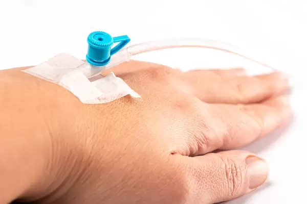 Catheter in a vein in a woman's hand