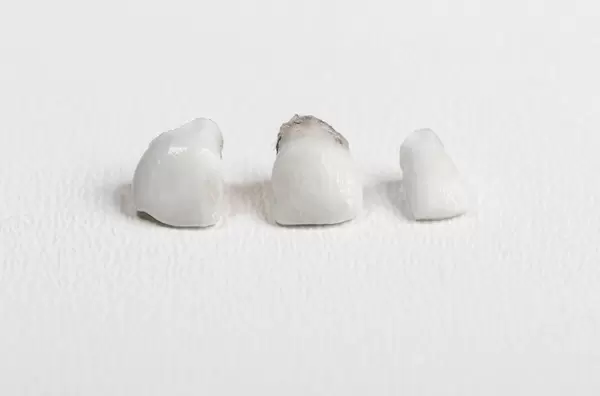 Children's first baby teeth that fell out on a white background