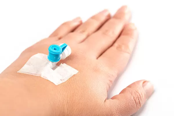 Close-up, female hand with a catheter in a vein