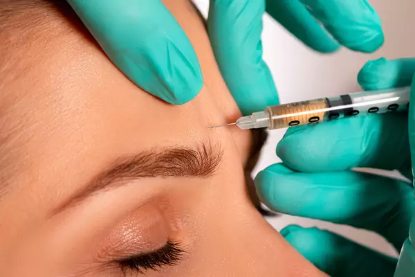 Close-up injection to smooth out wrinkles on a woman's forehead