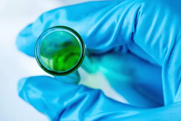 Close-up of a test tube with a solution in hand. Top view (Flip 2020)