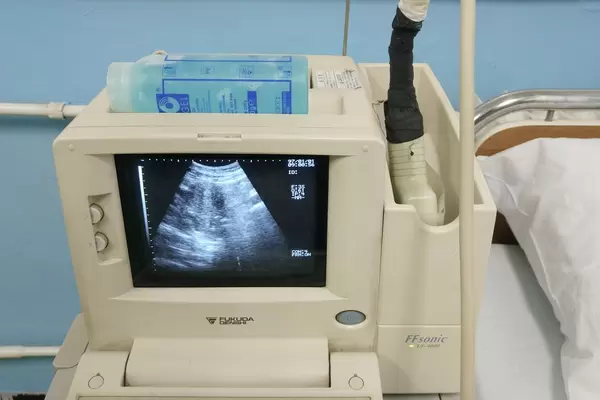 Close-up shot of a Fukuda Denshi UF-4100 ultrasound device