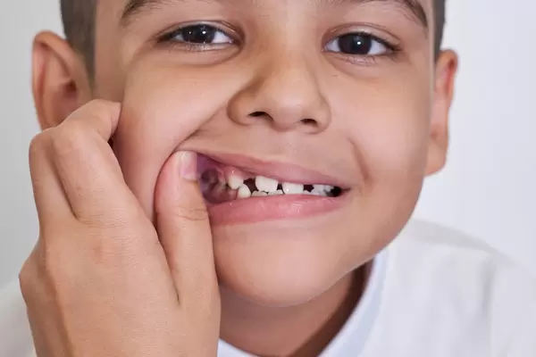 Close-up view of a little boy grimacing face while mother hands checking his teeth