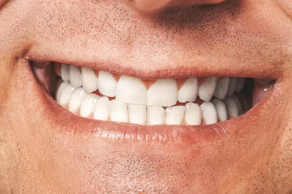 Closeup of male mouth. Healthy smile (Flip 2019)