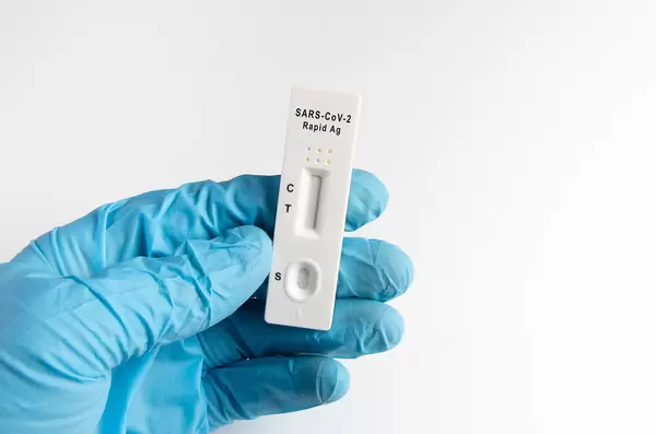 Coronavirus epidemic and Covid-19 concept with doctor holding immunoglobulin antibody blood test