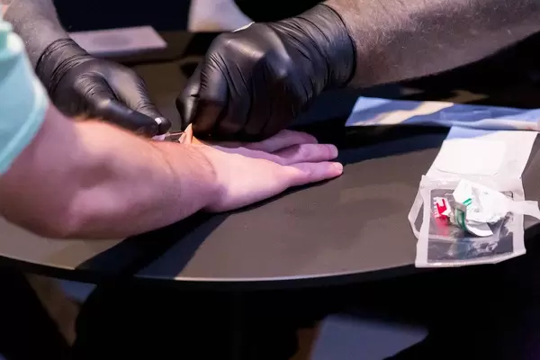 Der Implantationsvorgang von Biohax eines NFC Chips in die Hand