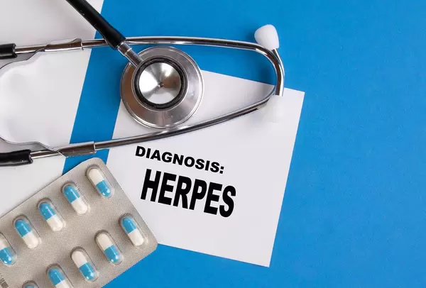 Diagnosis Herpes written on medical blue folder