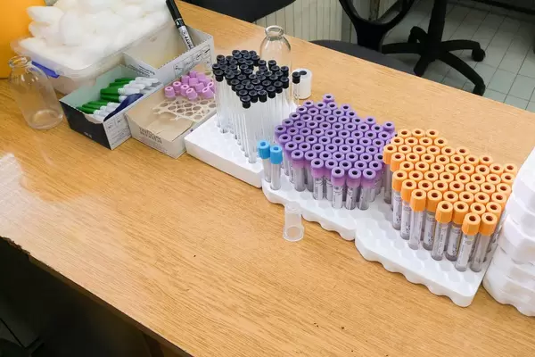 Different kinds of test tubes at a medical laboratory  Flip 2019