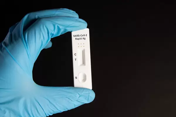 Doctor holding a test kit for viral disease tests with the COVID-19