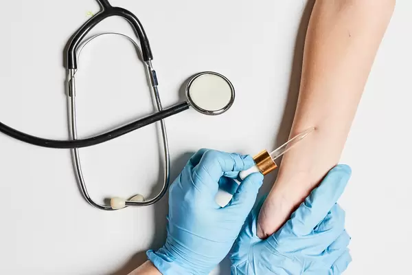 Doctor making allergy test at table, top view