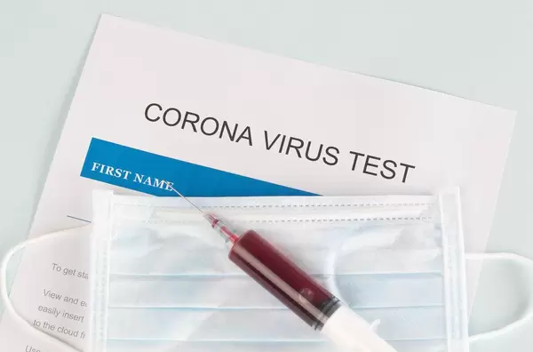 Draufsicht eines Coronavirus Tests mit Gesichtsmaske und Spritze mit Blut