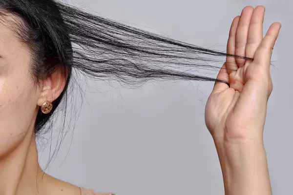 Female Hair Loss. Woman Holding Loss Hair