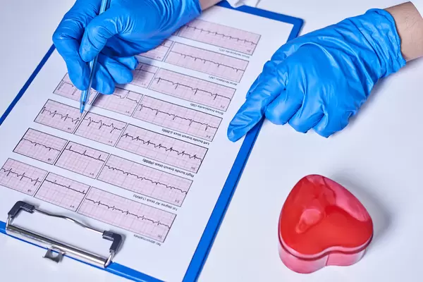 General practitioner examining EKG during a health check and medical consultation
