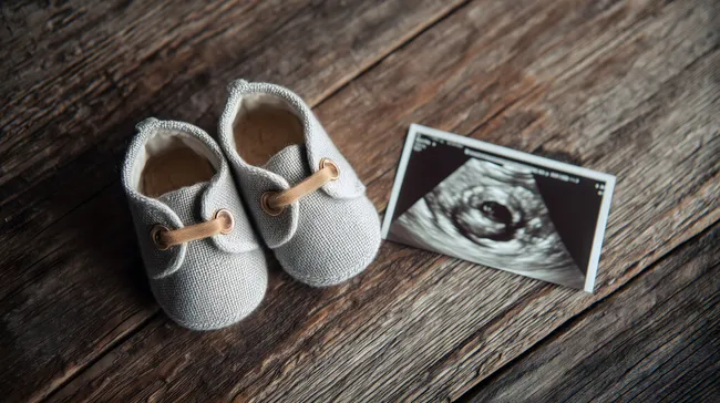 Graue Babyschuhe und Ultraschallbild auf rustikalem Holztisch