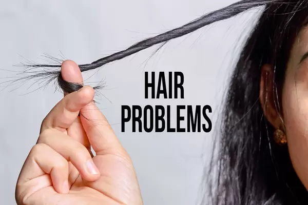 Hair problems of female - Causes, Symptoms, Treatments.