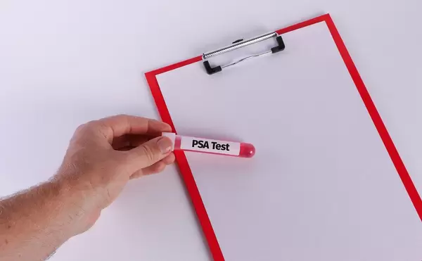 Hand holding test tube with PSA Test text