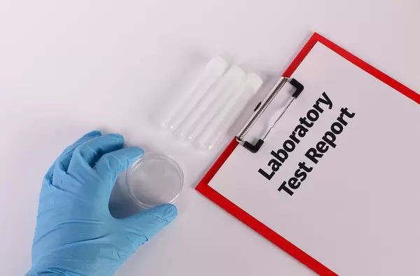 Hand in blue medical glove holding empty test tube and clipboard with Laboratory Test Report text
