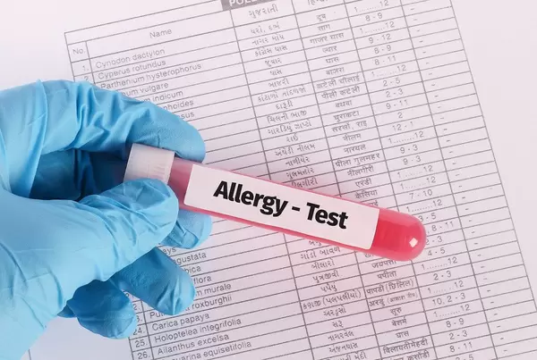 Hand in blue medical glove holding test tube with Allergy Test text
