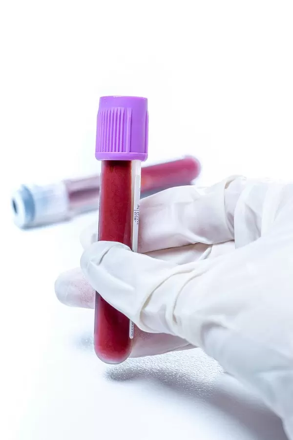 Hand in glove holding blood in test tube close up (Flip 2019)