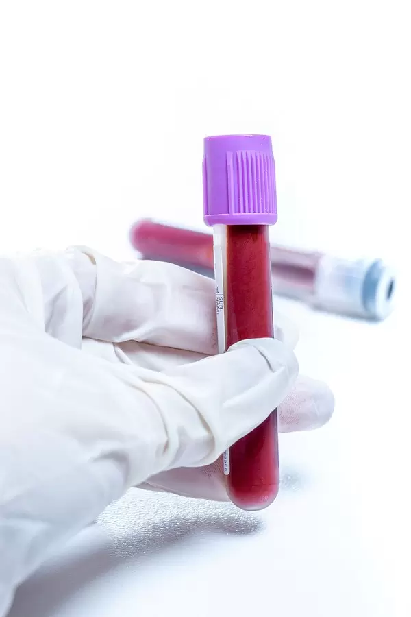 Hand in glove holding blood in test tube close up