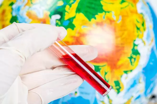 Hand in glove with a test tube of blood on a background of the globe