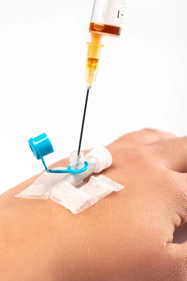 Injection of medication into a venous catheter from a syringe, close-up