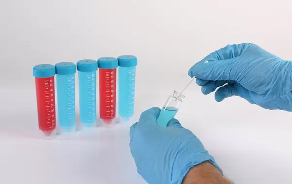 Lab assistant doing microbiological analysis