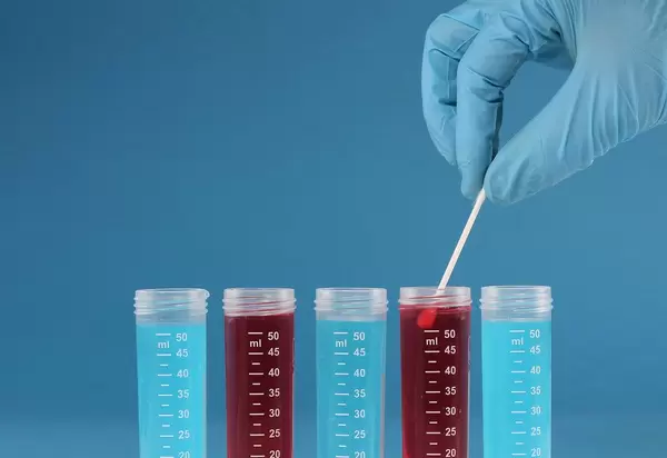 Laboratory assistant collecting samples for analysis