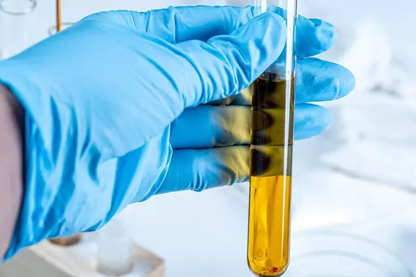 Laboratory test tube with orange solution in hand