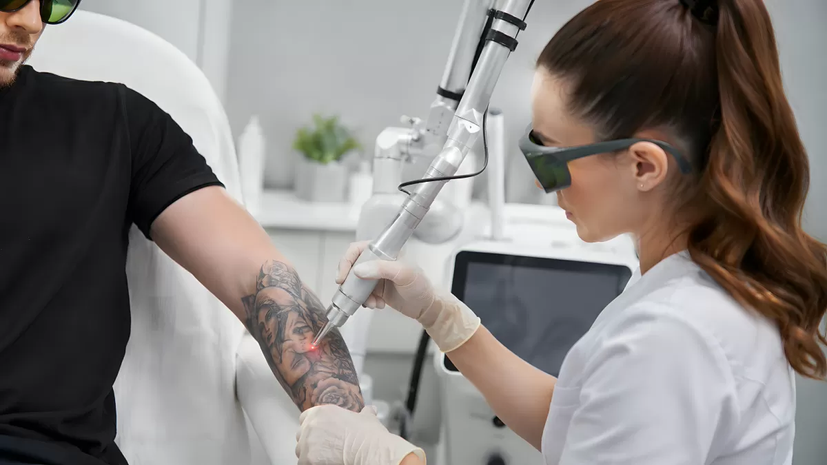 Laserbehandlung zur Tattooentfernung am Unterarm