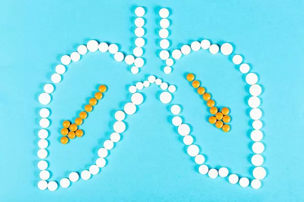 Lung diseases concept. Human lungs with arrows