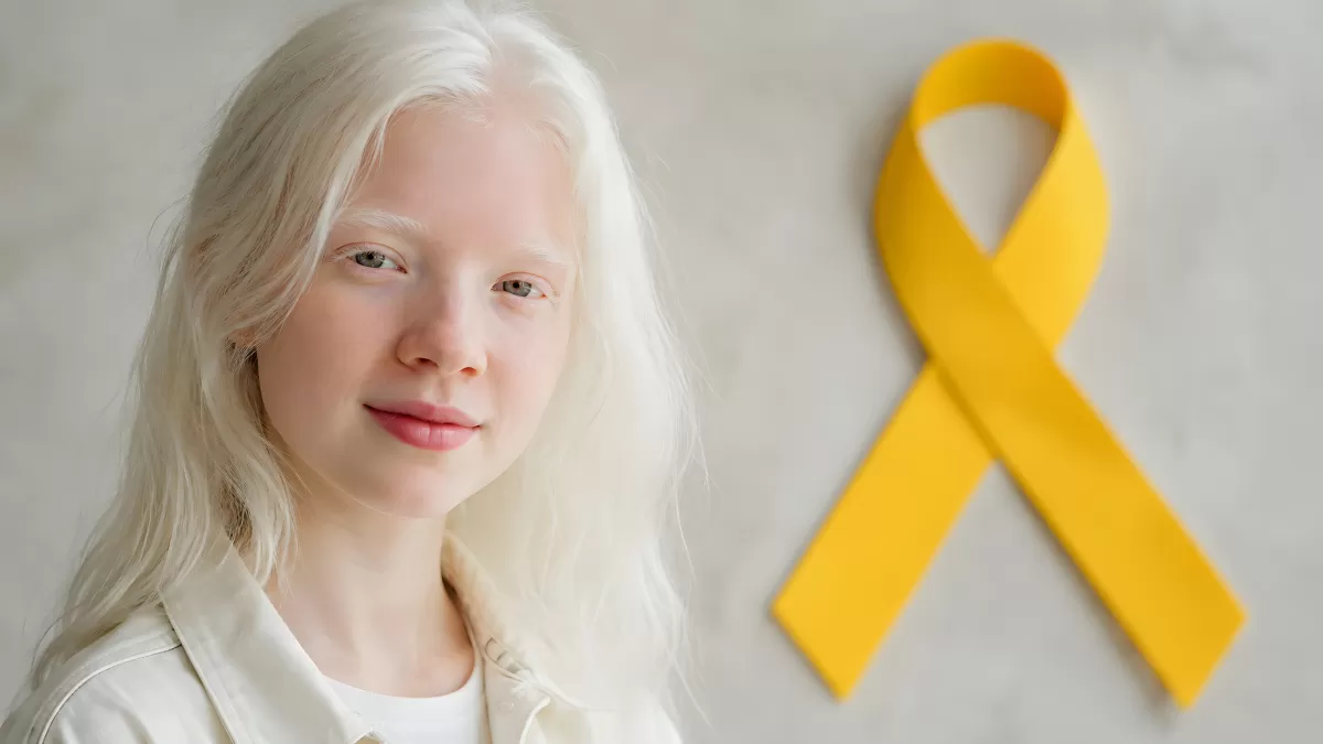 Mädchen mit Albinismus neben gelbem Bewusstseinsband