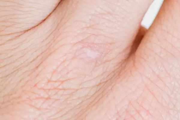 Nahaufnahme von Fingern zeigt Handlinien