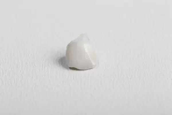 Small fallen milk tooth on a white background