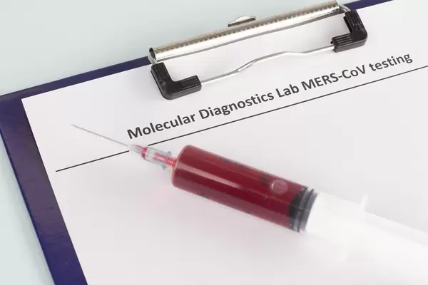 Spritze mit Blutprobe auf einem MERS Test auf einem Klemmbrett