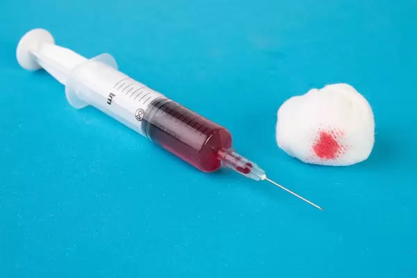 Taking blood sample (Flip 2019)