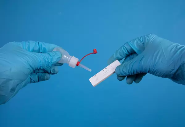 Test kit for viral disease COVID-19